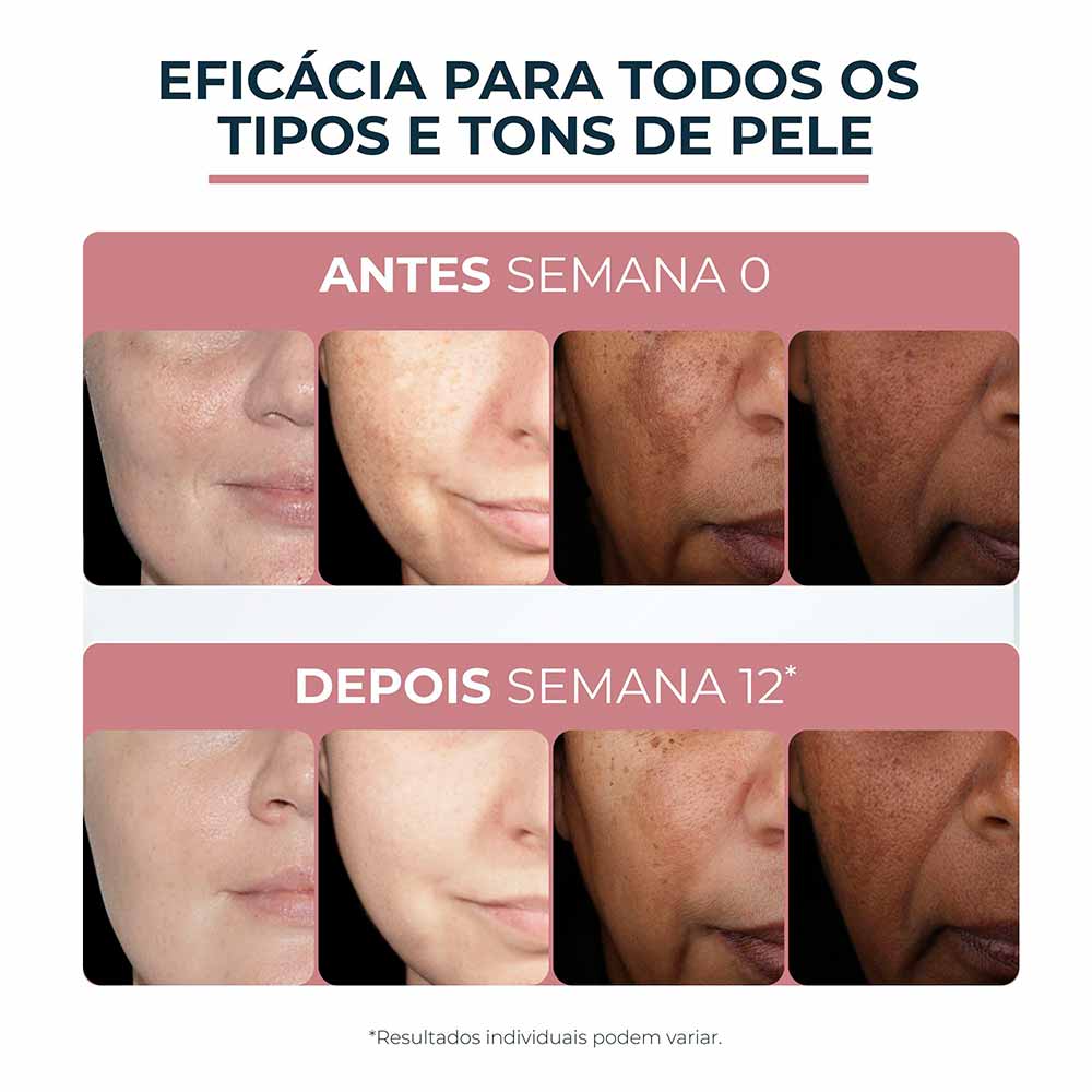 Eucerin Anti-pigment Clareador Creme Facial Dia FPS 30